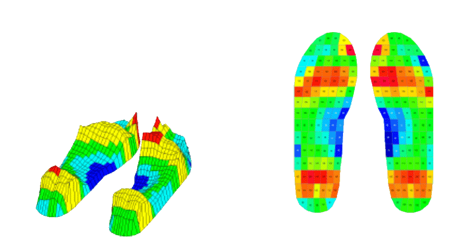 data map of pressure units on the foot